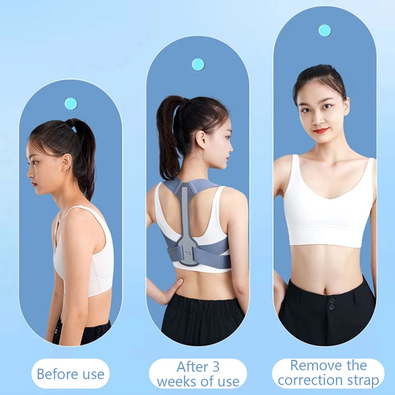 Adjustable Posture Corrector Brace